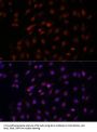 Apoptosis Regulator Bcl-2 (BCL2) Antibody
