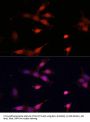 Apoptosis Regulator Bcl-2 (BCL2) Antibody