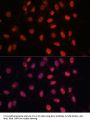 Apoptosis Regulator Bcl-2 (BCL2) Antibody