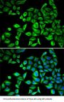 C-Reactive Protein (CRP) Antibody