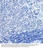 Histone Deacetylase 1 (HDAC1) Antibody