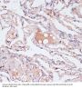 Interferon Gamma (IFNG) Antibody