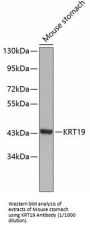 Keratin 19 (KRT19) Antibody