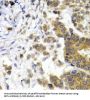 Neurofilament, Light Polypeptide (NEFL) Antibody