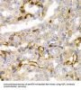 Neurofilament, Light Polypeptide (NEFL) Antibody