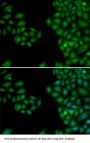 Neurofilament, Light Polypeptide (NEFL) Antibody