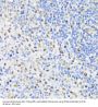 Proliferating Cell Nuclear Antigen (PCNA) Antibody