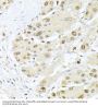 Proliferating Cell Nuclear Antigen (PCNA) Antibody