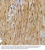 Peroxisome Proliferator Activated Receptor Gamma (PPARG) Antibody