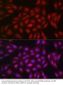Peroxisome Proliferator Activated Receptor Gamma (PPARG) Antibody