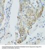 Sirtuin 2 (SIRT2) Antibody