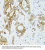 Sirtuin 2 (SIRT2) Antibody