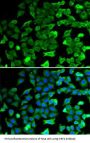 Sirtuin 2 (SIRT2) Antibody