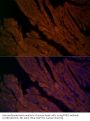 Ryanodine Receptor 2 (RYR2) Antibody