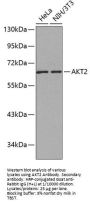 RAC-Beta Serine/threonine-Protein Kinase (AKT2) Antibody