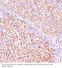Von Hippel-Lindau Disease Tumor Suppressor (VHL) Antibody
