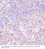 Von Hippel-Lindau Disease Tumor Suppressor (VHL) Antibody