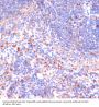 Von Hippel-Lindau Disease Tumor Suppressor (VHL) Antibody