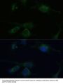 Von Hippel-Lindau Disease Tumor Suppressor (VHL) Antibody
