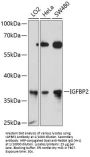 Insulin-Like Growth Factor-Binding Protein 2 (IGFBP2) Antibody
