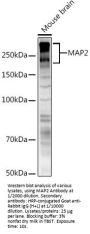 Microtubule Associated Protein 2 (MAP2) Antibody