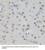 N-Myc Proto-Oncogene Protein (MYCN) Antibody