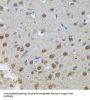 N-Myc Proto-Oncogene Protein (MYCN) Antibody