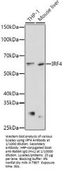Interferon Regulatory Factor 4 (IRF4) Antibody