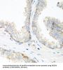 Neural Precursor Cell Expressed, Developmentally Down-Regulated 4, E3 Ubiquitin (NEDD4) Antibody