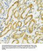 Heat Shock 70 kDa Protein 9 (HSPA9) Antibody