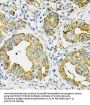 Heat Shock 70 kDa Protein 9 (HSPA9) Antibody