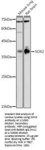 Transcription Factor SOX-2 (SOX2) Antibody