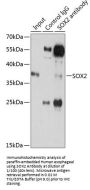 Transcription Factor SOX-2 (SOX2) Antibody