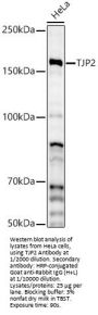Tight Junction Protein ZO-2 (TJP2) Antibody