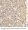 Sodium/Potassium-Transporting ATPase Subunit Alpha 1 (ATP1A1) Antibody