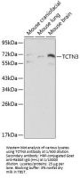 Tectonic Family Member 3 (TCTN3) Antibody