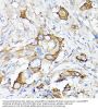 Matrix Metalloproteinase-7 (MMP7) Antibody