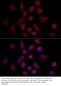 Matrix Metalloproteinase-7 (MMP7) Antibody