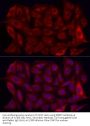 Matrix Metalloproteinase-7 (MMP7) Antibody