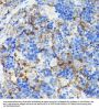 Tyrosine-Protein Kinase CSK (CSK) Antibody