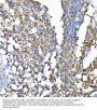 Tyrosine-Protein Kinase CSK (CSK) Antibody