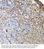Tyrosine-Protein Kinase CSK (CSK) Antibody