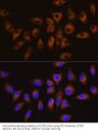 Tyrosine-Protein Kinase CSK (CSK) Antibody