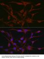 Tyrosine-Protein Kinase CSK (CSK) Antibody