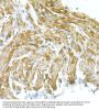 Voltage-Dependent Anion-Selective Channel Protein 1 (VDAC1) Antibody