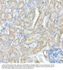 Voltage-Dependent Anion-Selective Channel Protein 1 (VDAC1) Antibody