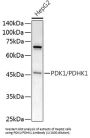 Pyruvate Dehydrogenase Kinase Isozyme 1 (PDK1) Antibody
