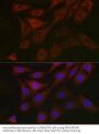 Pyruvate Dehydrogenase Kinase Isozyme 1 (PDK1) Antibody