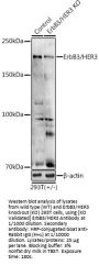 V-Erb B2 Erythroblastic Leukemia Viral Oncogene Homolog 3 (ERBB3) Antibody