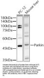 E3 Ubiquitin-Protein Ligase Parkin (PRKN) Antibody